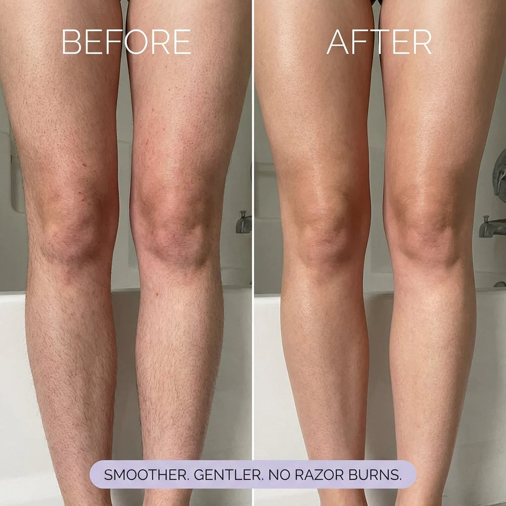 Hair Removal Mousse