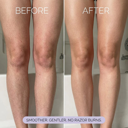Hair Removal Mousse