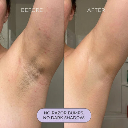 Hair Removal Mousse